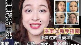 果酸视频,揭秘护肤界的神奇果酸,让你的肌肤焕发光彩